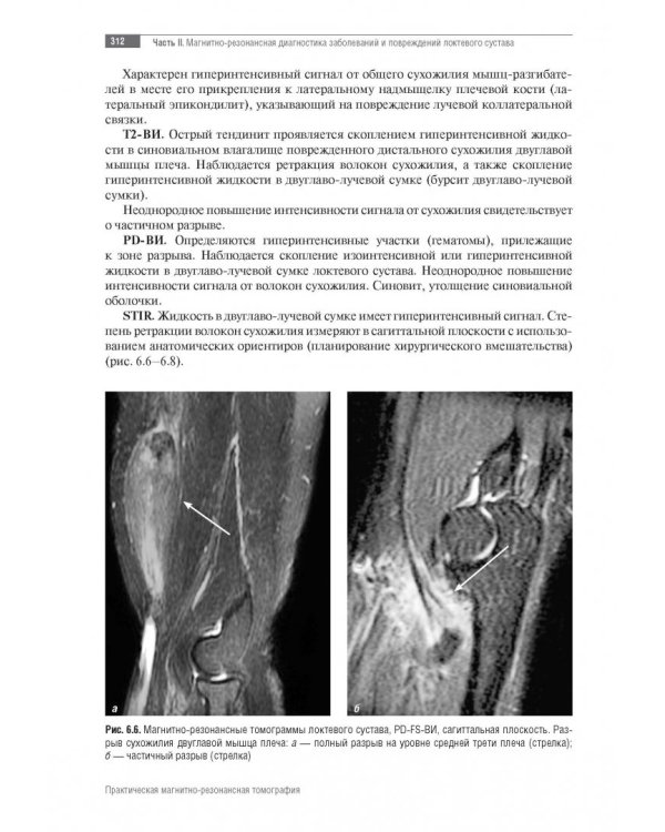 МРТ. Суставы верхней конечности. Руководство для врачей