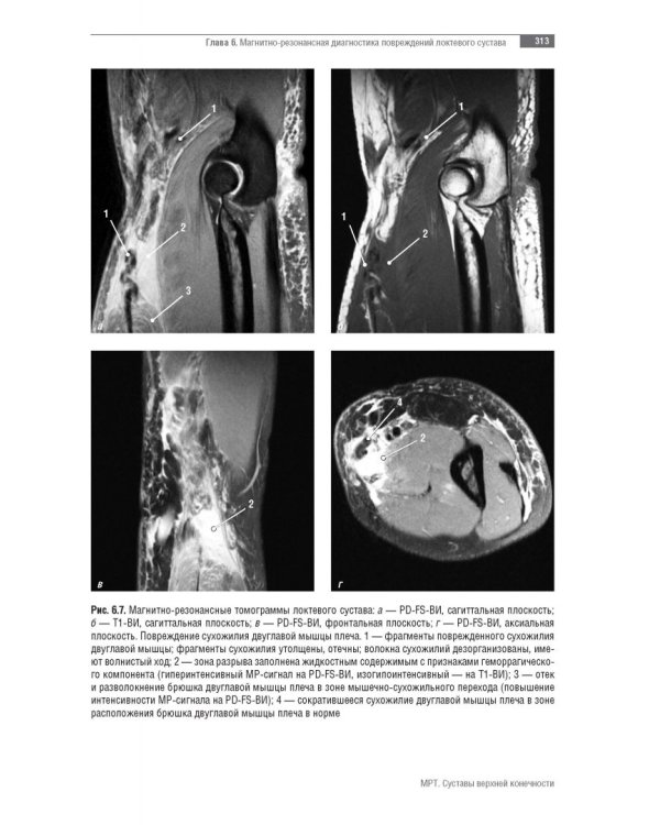 МРТ. Суставы верхней конечности. Руководство для врачей