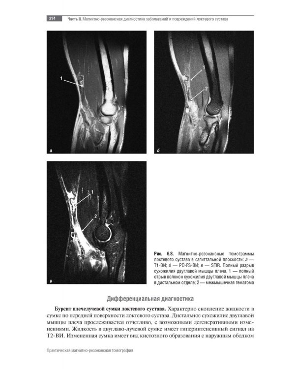 МРТ. Суставы верхней конечности. Руководство для врачей