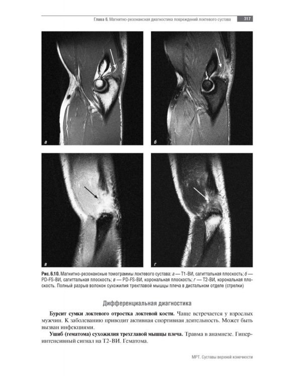МРТ. Суставы верхней конечности. Руководство для врачей
