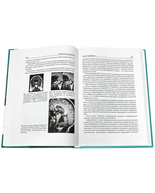 Неврология и нейрохирургия. Том 2. Нейрохирургия