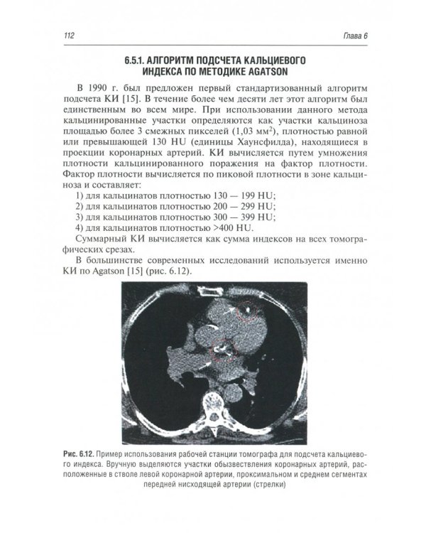 Томография сердца. Руководство для врачей
