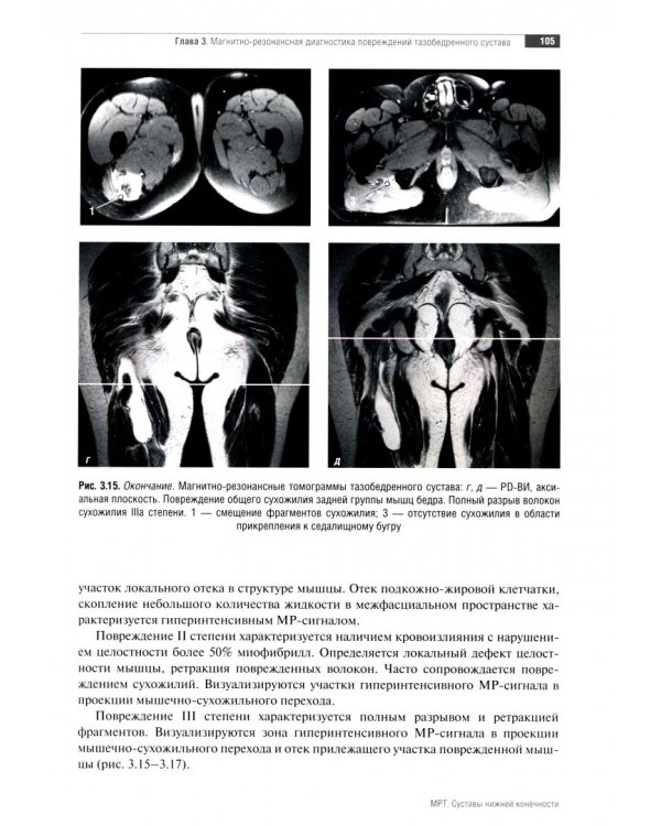 МРТ. Суставы нижней конечности. Руководство для врачей