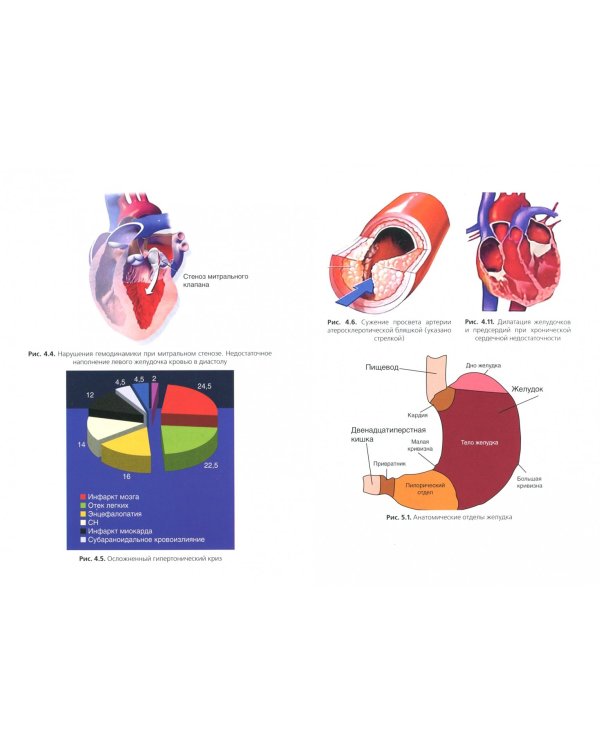 Сестринский уход в терапии. Участие в лечебно-диагностическом процессе. Учебник