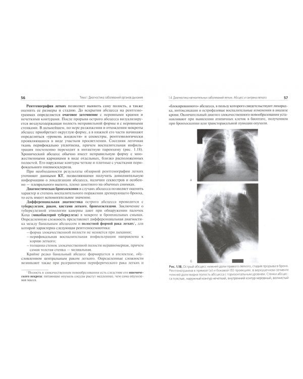Диагностика терапевтических заболеваний. Учебник