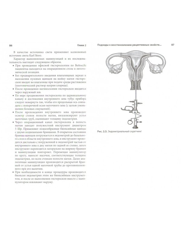 Тонкий эндометрий. Лечение бесплодия у женщин с гипоплазией эндометрия