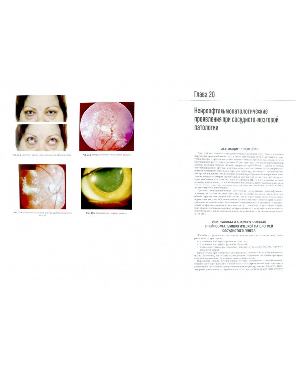 Неврология. Национальное руководство. В 2-х томах. Том 2