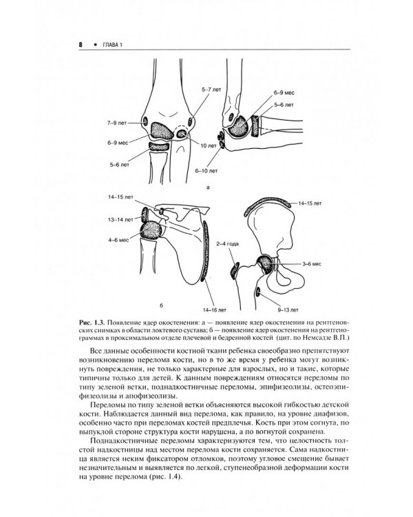 Детская травматология