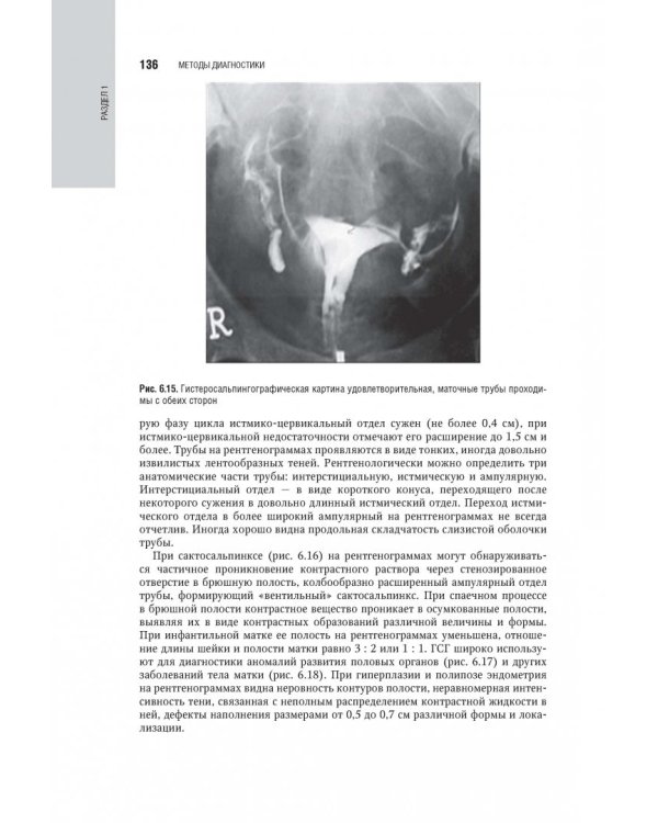 Гинекология. Национальное руководство