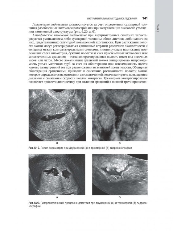 Гинекология. Национальное руководство