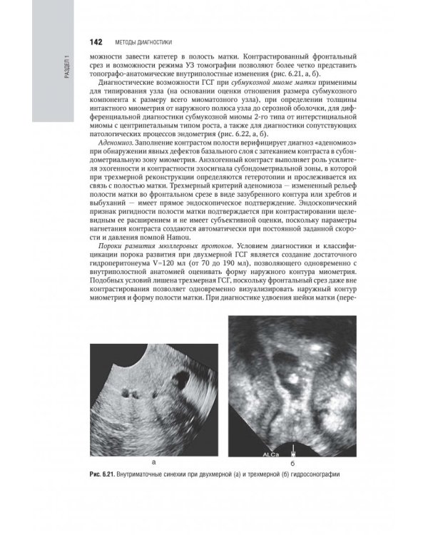 Гинекология. Национальное руководство