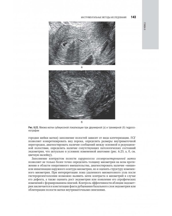Гинекология. Национальное руководство
