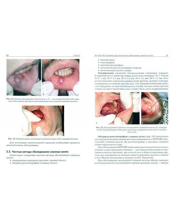 Хирургическая стоматология. Воспалительные и дистрофические заболевания слюнных желез
