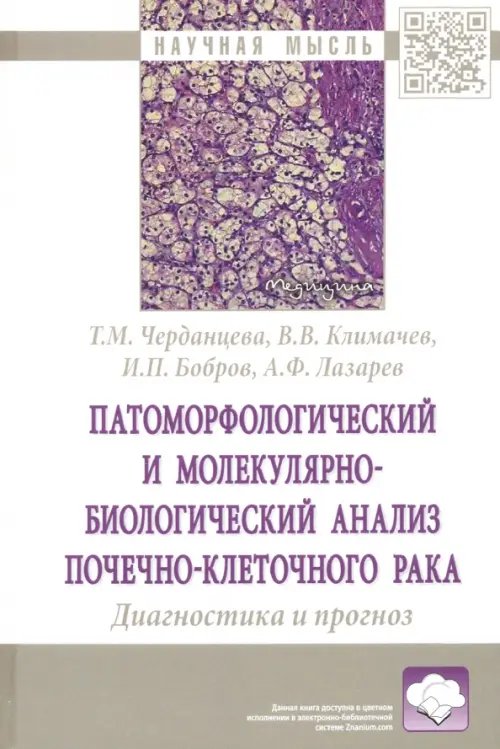 Патоморфологический и молекулярно-биологический анализ почечно-клеточного рака.Диагностика и прогноз