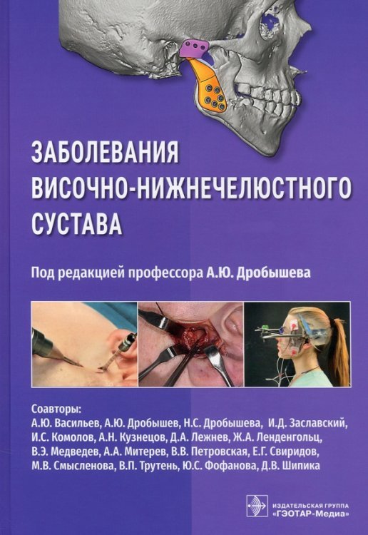 Заболевания височно-нижнечелюстного сустава