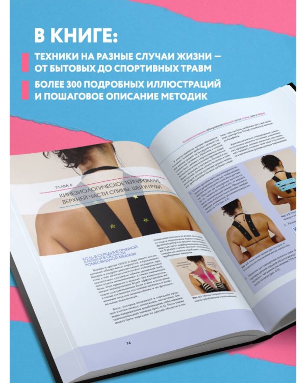 Кинезиологическое тейпирование