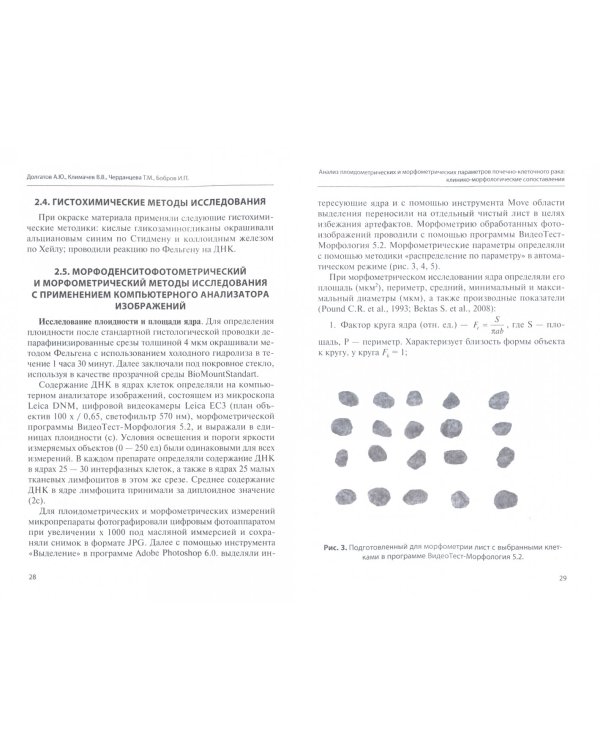 Анализ плоидометрических и морфометрических параметров почечно-клеточного рака. Монография