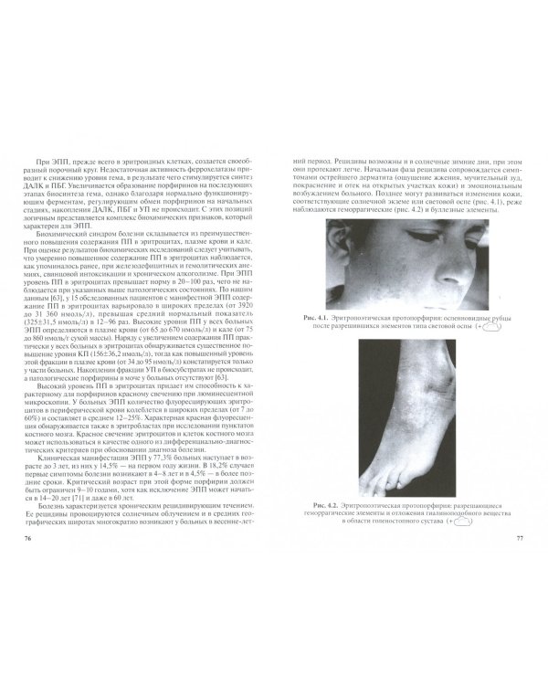 Заболевания внутренних органов при манифестных и латентных нарушениях порфиринового обмена