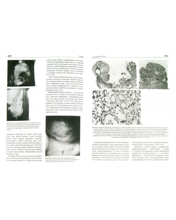 Доброкачественные заболевания вульвы и влагалища