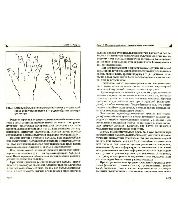 Артрит. Избавляемся от болей в суставах