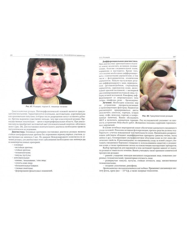 Дерматовенерология. Учебник