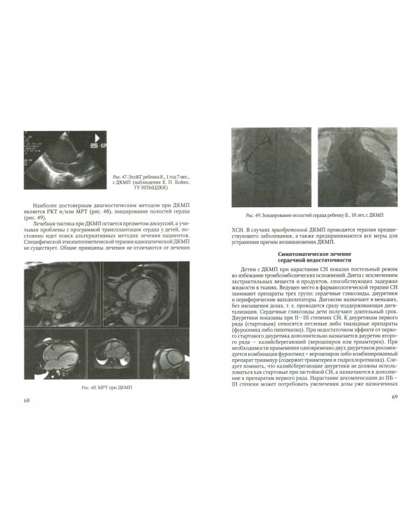 Диагностика различных вариантов кардиомиопатий у детей. Новый взгляд на старую проблему