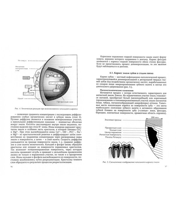 Кариес зубов. Учебное пособие для студентов