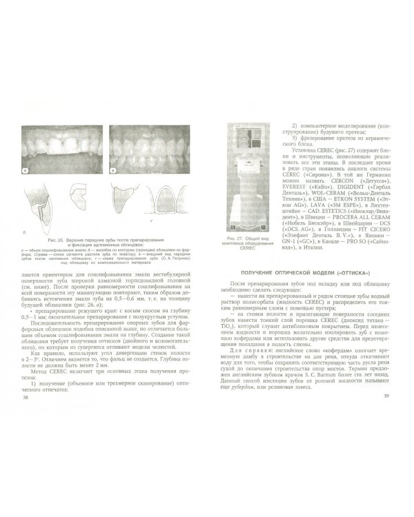 Протетическая реставрация зубов (система CEREC)