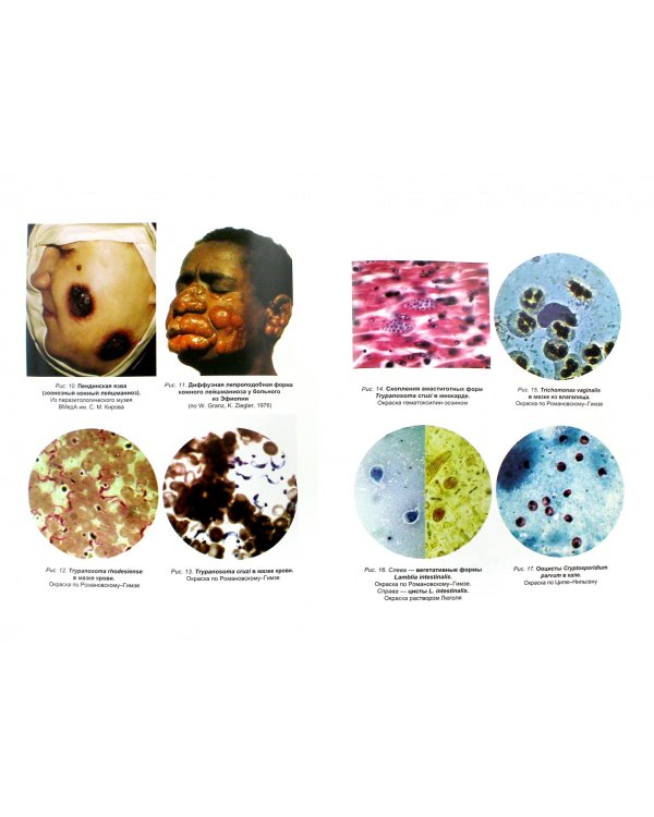 Паразитарные болезни человека. Протозоозы и гельментозы