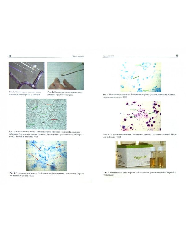Лабораторная диагностика урогенитального трихомониаза. Методические рекомендации