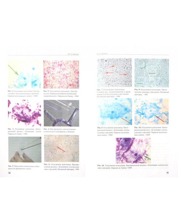 Лабораторная диагностика бактериального вагиноза. Методические рекомендации