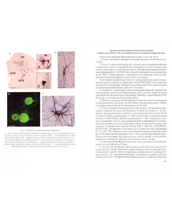 Иммуноцитохимия и конфокальная микроскопия