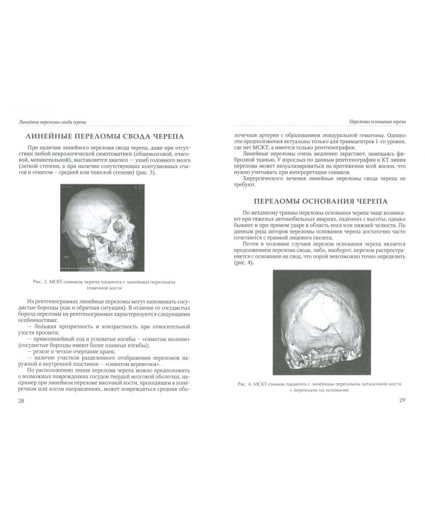 Нейротравматология (с позиции трехуровневой системы оказания помощи). Руководство для врачей