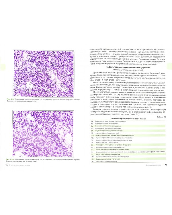 Опухоли мочевыделительной системы и мужских половых органов. Морфологическая диагностика и генетика