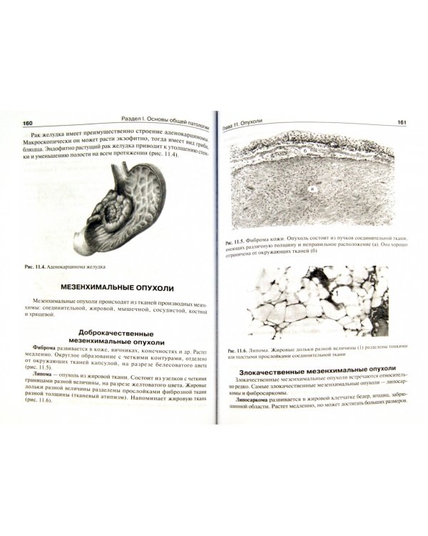 Основы патологии. Учебник для медицинских училищ и колледжей + CD