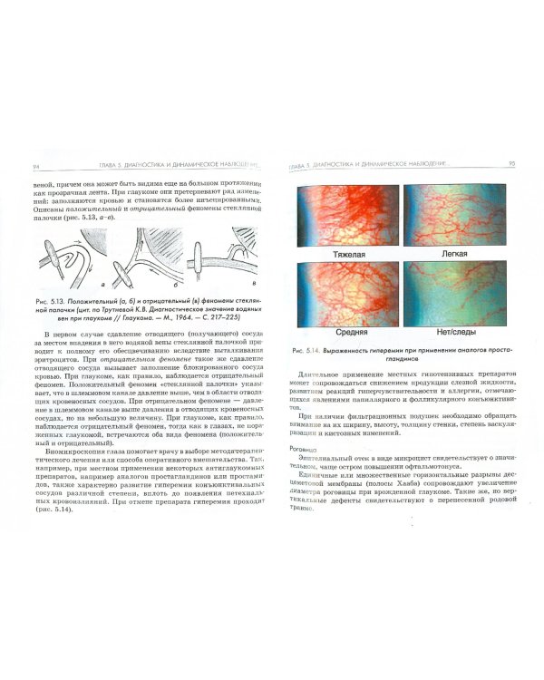 Национальное руководство по глаукоме