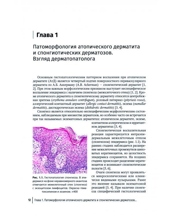 Атопический дерматит. Междисциплинарный подход