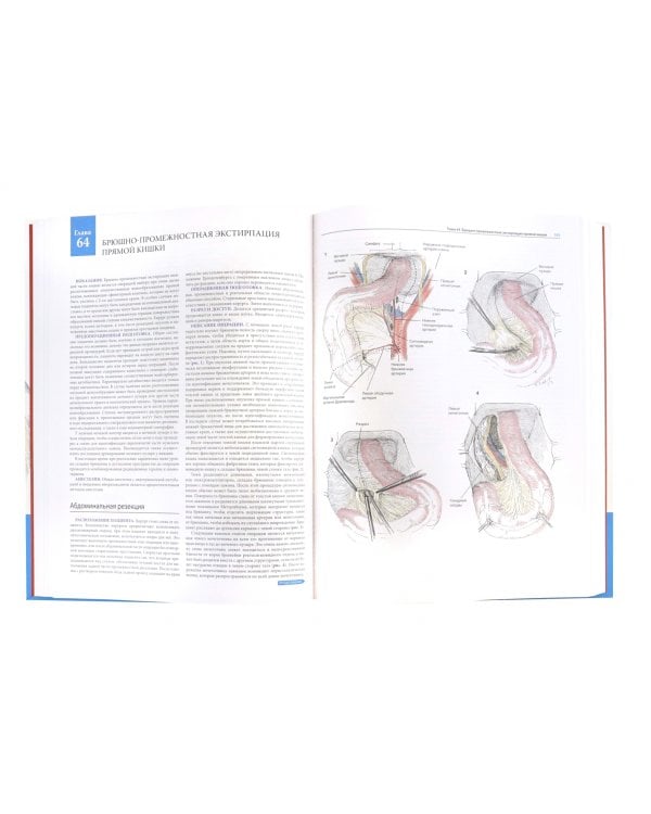 Атлас хирургических операций Золлингера
