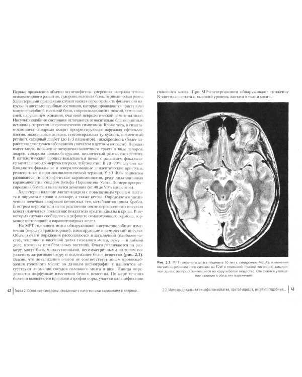 Митохондриальные заболевания. Руководство
