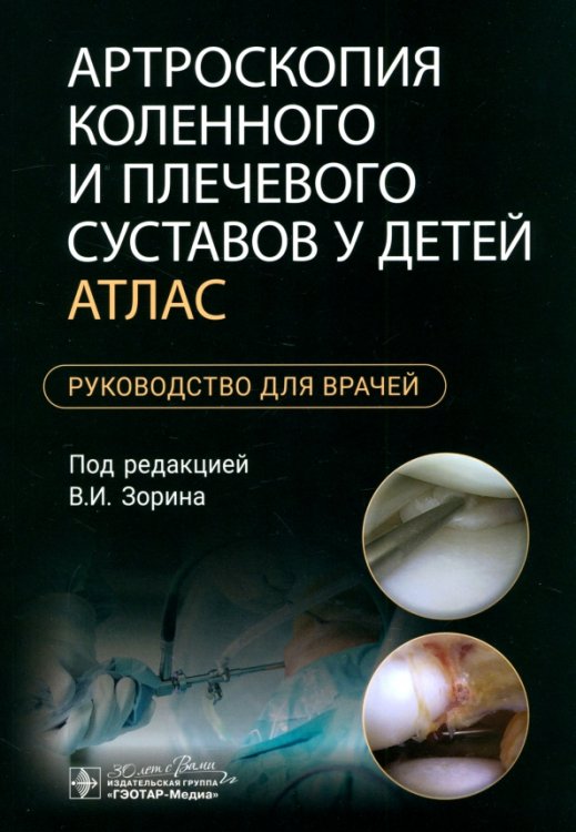 Артроскопия коленного и плечевого суставов у детей. Атлас. Руководство для врачей
