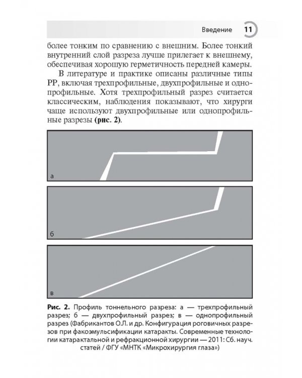 Техника роговичного разреза в хирургии катаракты