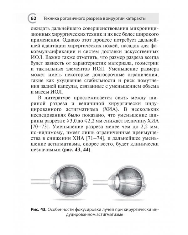 Техника роговичного разреза в хирургии катаракты