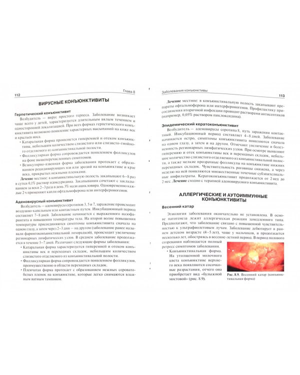 Офтальмология. Учебник