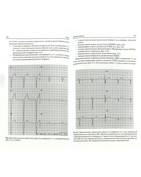Быстрый анализ ЭКГ