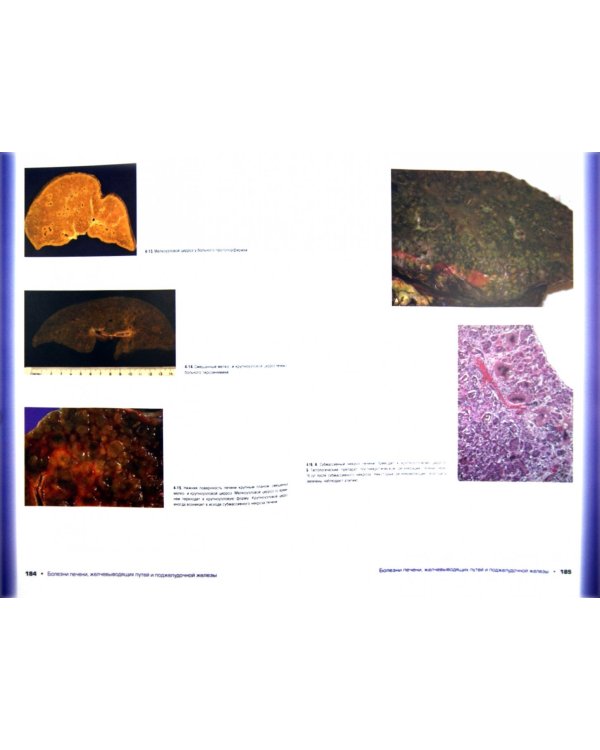 Атлас патологии. Макро- и микроскопические изменения органов