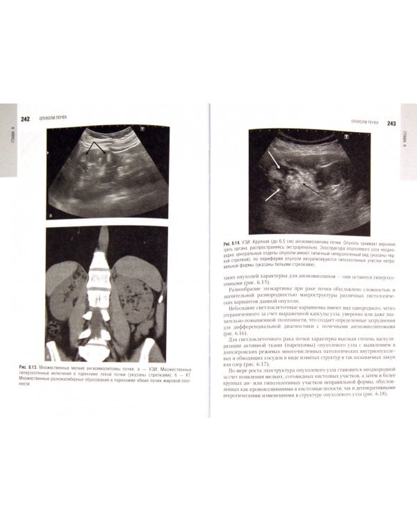 Лучевая диагностика и терапия в урологии