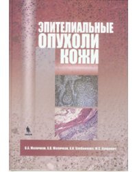 Эпителиальные опухоли кожи