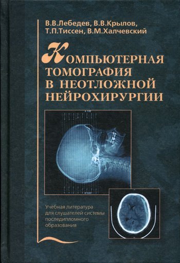 Обложка книги «Компьютерная томография в неотложной нейрохирургии. Учебная литература для слушателей системы последипломного образования. Гриф УМО по медицинскому образованию» — Лебедев В.В., Крылов В.В., Тиссен Т.П., Халчевский В.М., ISBN 5225047823