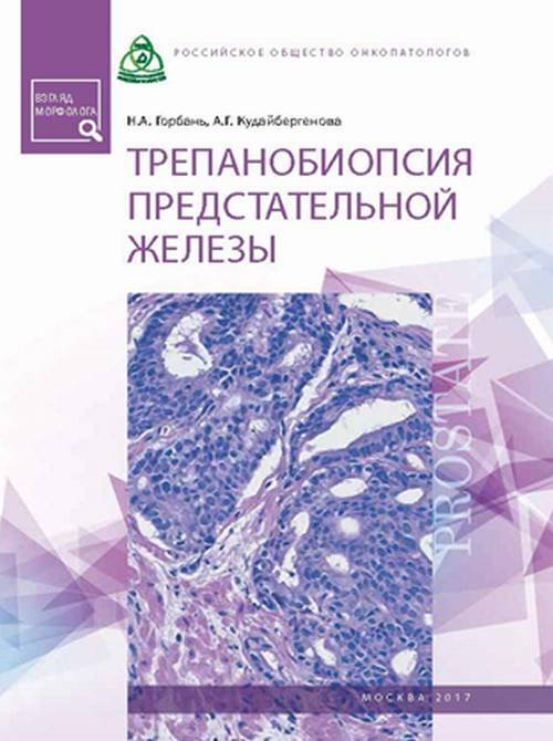 Обложка книги «Трепанобиопсия предстательной железы / Горбань Н.А.», ISBN 9785903018512