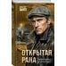 Открытая рана